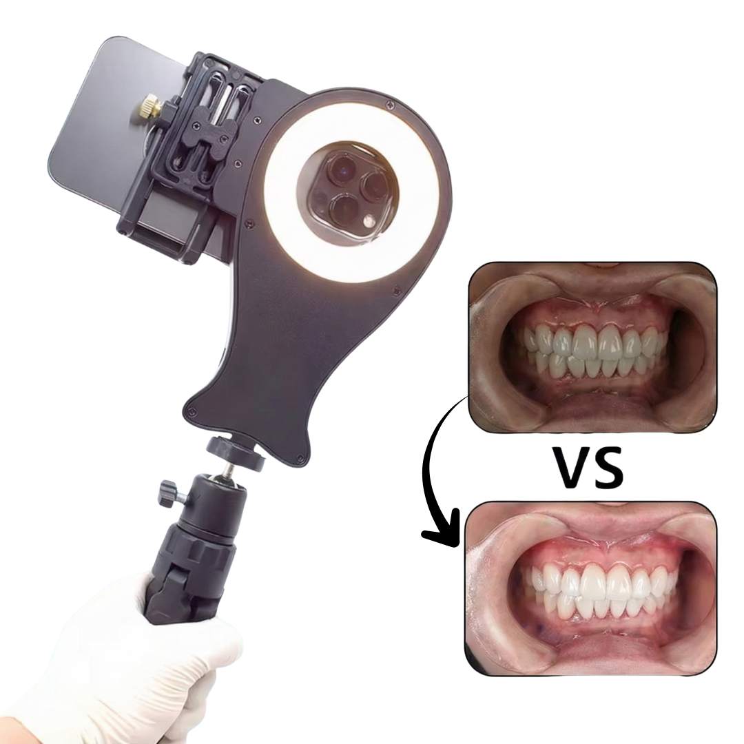 Oral-Fotografie-Halter V4 – kompatibel mit jedem iPhone- und Android-Modell